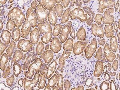 Immunohistochemistry-Paraffin: ZNF248 Antibody [NBP2-97882]