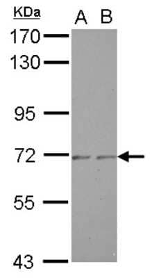 Western Blot: ZNF248 Antibody [NBP2-15168]