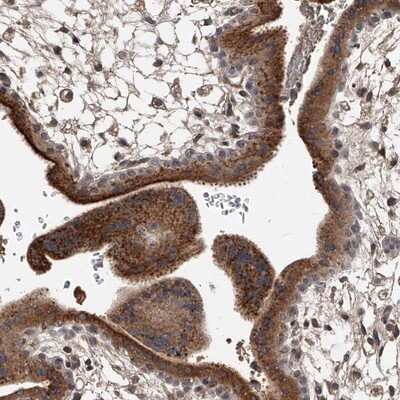 Immunohistochemistry-Paraffin: ZNF25 Antibody [NBP1-82013]