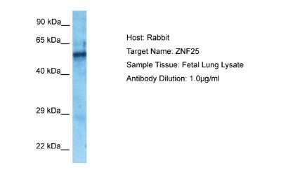 Western Blot: ZNF25 Antibody [NBP2-83840]