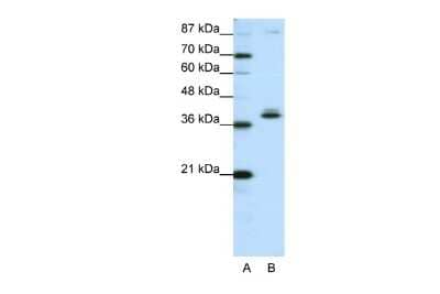 Western Blot: ZNF25 Antibody [NBP2-83842]