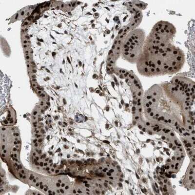Immunohistochemistry-Paraffin: ZNF250 Antibody [NBP1-81052]