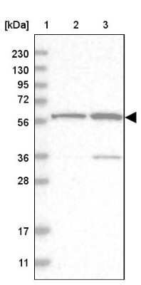 Western Blot: ZNF250 Antibody [NBP1-81052]