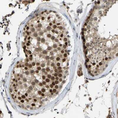 Immunohistochemistry-Paraffin: ZNF251 Antibody [NBP1-91084]