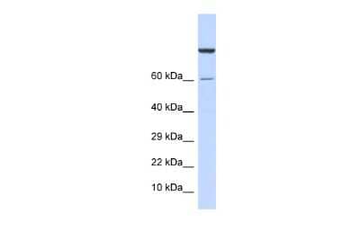 Western Blot: ZNF251 Antibody [NBP2-83844]