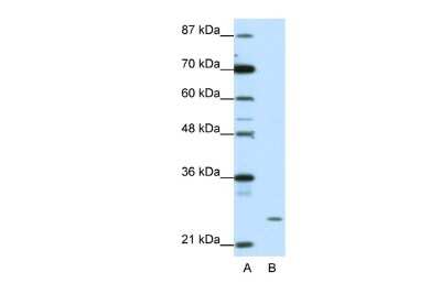 Western Blot: ZNF253 Antibody [NBP2-86910]