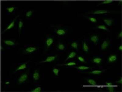 Immunocytochemistry/ Immunofluorescence: ZNF256 Antibody (3H7) [H00010172-M01]