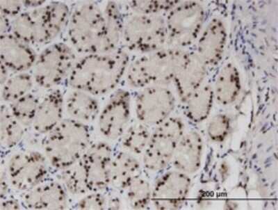 Immunohistochemistry-Paraffin: ZNF256 Antibody (3H7) [H00010172-M01]