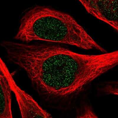 Immunocytochemistry/ Immunofluorescence: ZNF256 Antibody [NBP2-47569]