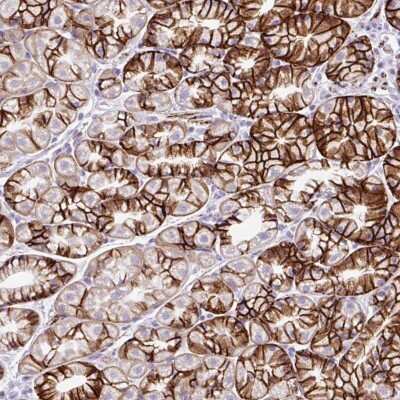 Immunohistochemistry: ZNF256 Antibody [NBP2-47569]