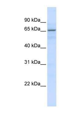 Western Blot: ZNF256 Antibody [NBP1-79233]