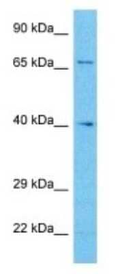 Western Blot: ZNF256 Antibody [NBP3-09237]