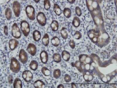 Immunohistochemistry-Paraffin: ZNF259 Antibody (6F7) [H00008882-M01]