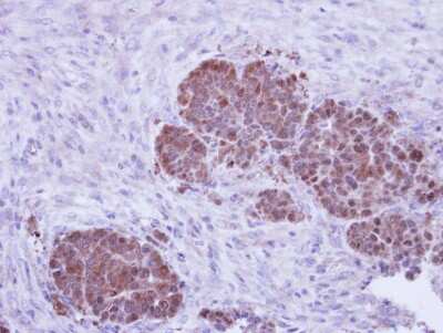 Immunohistochemistry-Paraffin: ZNF259 Antibody [NBP1-32965]