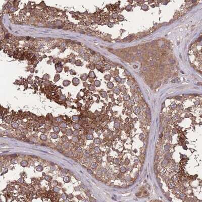 Immunohistochemistry-Paraffin: ZNF259 Antibody [NBP2-38172]