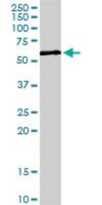 Western Blot: ZNF259 Antibody [H00008882-D01P]