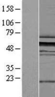 Western Blot: ZNF259 Overexpression Lysate [NBL1-18102]