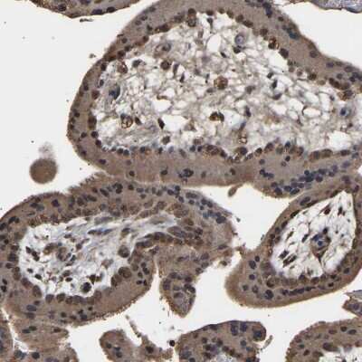 Immunohistochemistry-Paraffin: ZNF26 Antibody [NBP1-82161]