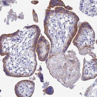 Immunohistochemistry-Paraffin: ZNF26 Antibody [NBP2-46673]