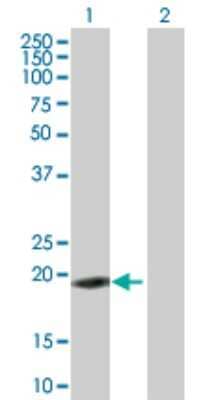 Western Blot: ZNF26 Antibody [H00007574-B01P]