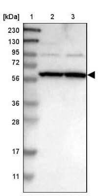 Western Blot: ZNF26 Antibody [NBP1-82161]