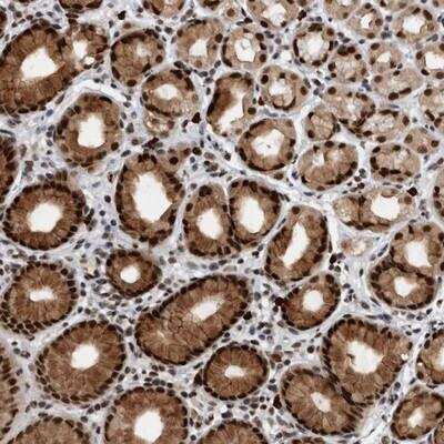 Immunohistochemistry-Paraffin: ZNF260 Antibody [NBP1-80967]