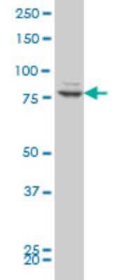 Western Blot: ZNF263 Antibody (2A1) [H00010127-M03]