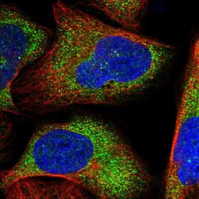 Immunocytochemistry/ Immunofluorescence: ZNF263 Antibody [NBP1-81869]