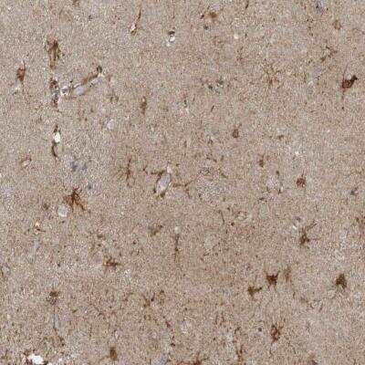 Immunohistochemistry-Paraffin: ZNF263 Antibody [NBP1-81868]