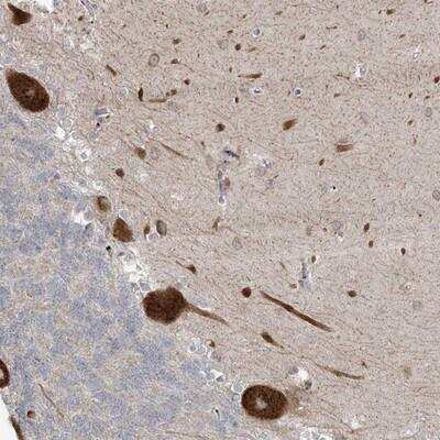 Immunohistochemistry-Paraffin: ZNF263 Antibody [NBP1-81869]