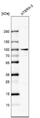 Western Blot: ZNF263 Antibody [NBP1-81868]