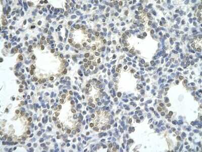 Immunohistochemistry: ZNF264 Antibody [NBP1-80297]