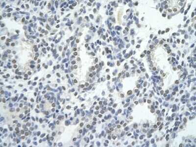Immunohistochemistry: ZNF264 Antibody [NBP1-80298]