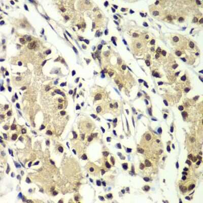 Immunohistochemistry-Paraffin: ZNF264 Antibody - BSA Free [NBP2-94825]