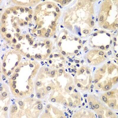 Immunohistochemistry-Paraffin: ZNF264 Antibody - BSA Free [NBP2-94825]