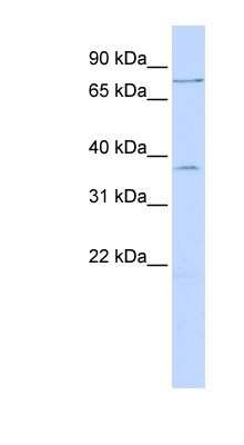 Western Blot: ZNF264 Antibody [NBP1-80297]