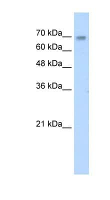 Western Blot: ZNF264 Antibody [NBP1-80298]