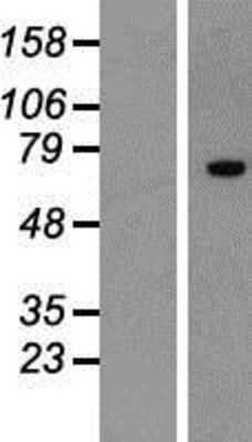 Western Blot: ZNF264 Overexpression Lysate [NBP2-08014]