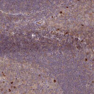 Immunohistochemistry-Paraffin: ZNF266 Antibody [NBP2-47567]