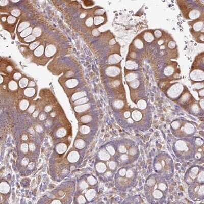 Immunohistochemistry-Paraffin: ZNF266 Antibody [NBP2-47568]