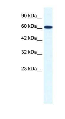 Western Blot: ZNF266 Antibody [NBP1-80114]