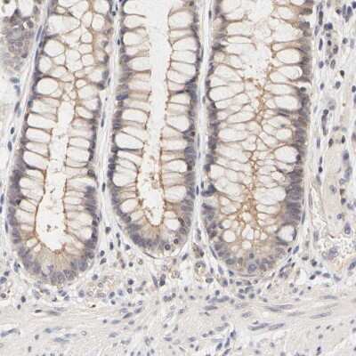 Immunohistochemistry-Paraffin: ZNF267 Antibody [NBP1-81633]
