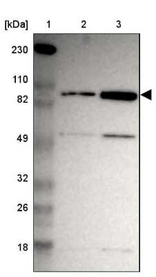 Western Blot: ZNF267 Antibody [NBP1-81633]