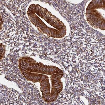 Immunohistochemistry-Paraffin: ZNF268 Antibody [NBP2-13562]