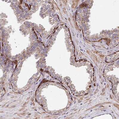 Immunohistochemistry-Paraffin: ZNF268 Antibody [NBP2-13562]
