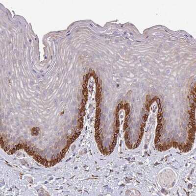 Immunohistochemistry-Paraffin: ZNF268 Antibody [NBP2-13562]