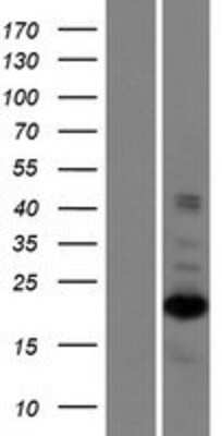 Western Blot: ZNF268 Overexpression Lysate [NBP2-10224]