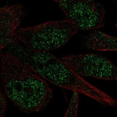 Immunocytochemistry/ Immunofluorescence: ZNF273 Antibody [NBP2-69045]