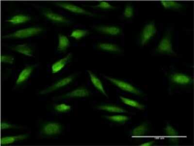 Immunocytochemistry/ Immunofluorescence: ZNF274 Antibody (2F5) [H00010782-M02]