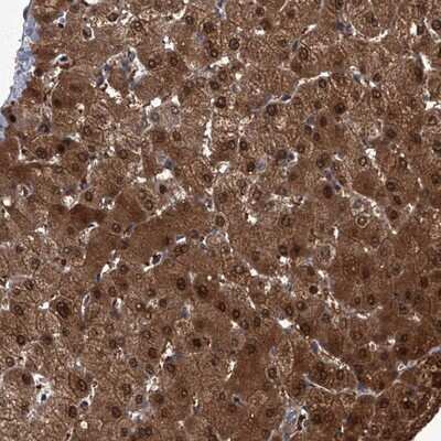 Immunohistochemistry-Paraffin: ZNF274 Antibody [NBP1-80597]